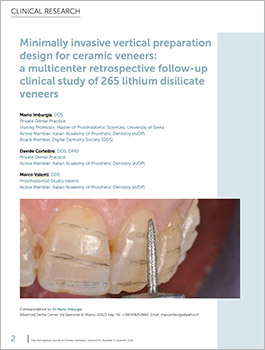 Minimally invasive vertical preparation design for ceramic veneers: a multicenter retrospective follow-up clinical study of 265 lithium disilicate veneers.