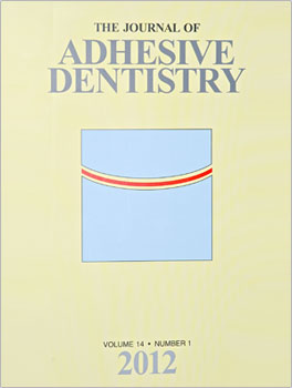 BONDING LITHIUM DISILICATE CERAMIC TO FEATHER-EDGE TOOTH PREPARATIONS: A MINIMALLY INVASIVE TREATMENT CONCEPT