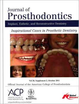 DURABILITY AND WEIBULL CHARACTERISTICS OF LITHIUM DISILICATE CROWNS BONDED ON ABUTMENTS WITH KNIFE-EDGE AND LARGE CHAMFER FINISH LINES AFTER CYCLIC LOADING