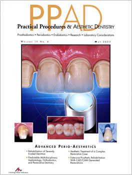 REHABILITATION OF SEVERELY ERODED DENTITION UTILIZING ALL-CERAMIC RESTORATIONS.